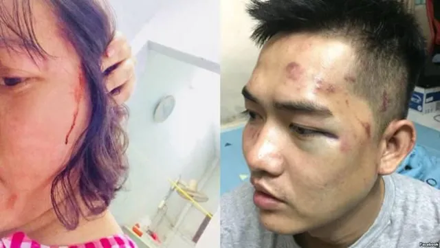 Bild: Musiker und Besucher eines Musikevents in Vietnam von der Polizei angegriffen und schwer misshandelt