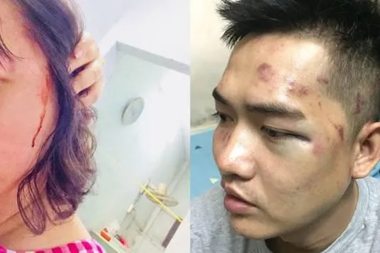 Bild: Musiker und Besucher eines Musikevents in Vietnam von der Polizei angegriffen und schwer misshandelt