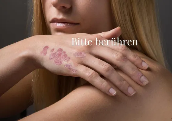 Bild: 'Bitte berühren' – gegen Berührungsmangel bei Schuppenflechte