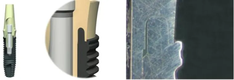 Bild: Auch Zahnimplantate unterscheiden sich in der Qualität