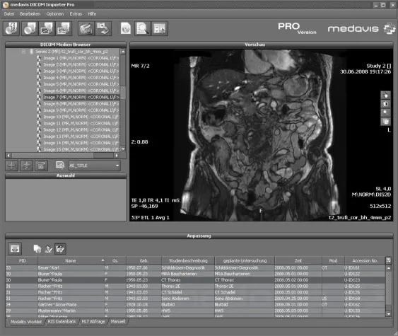 Systemunabhängige Lösung für DICOM-Datenimport Bild: Systemunabhängige Lösung für DICOM-Datenimport