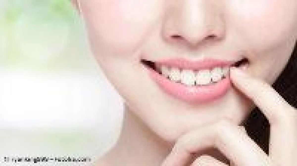 Lückenloses Lächeln dank einem Implantat oder einer Brücke / © ryanking999 ? Fotolia.com