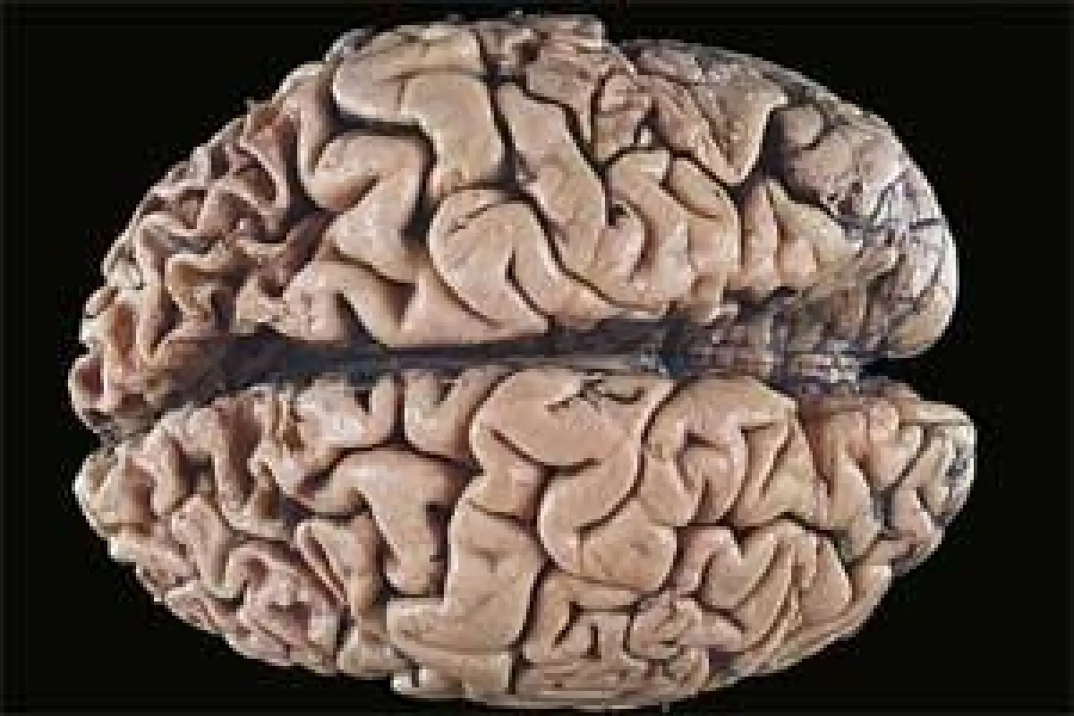 Gehirnathropie ©medicalpicture