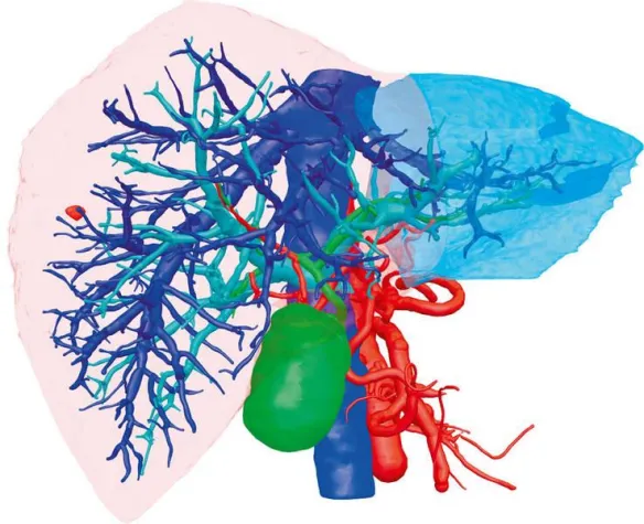 Operieren am 3D-Modell - IT-Lösungen auf dem Weg in den Markt Bild: Operieren am 3D-Modell - IT-Lösungen auf dem Weg in den Markt