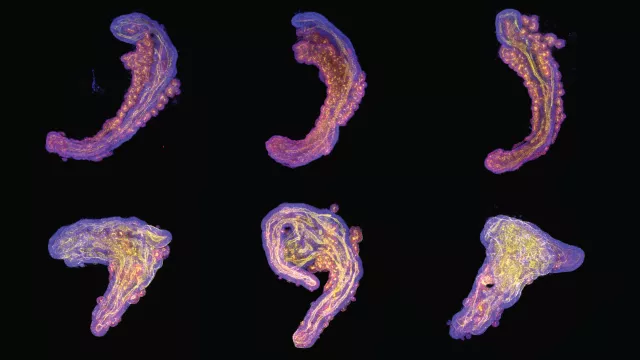 Bild: Stoffwechsel prägt Leben