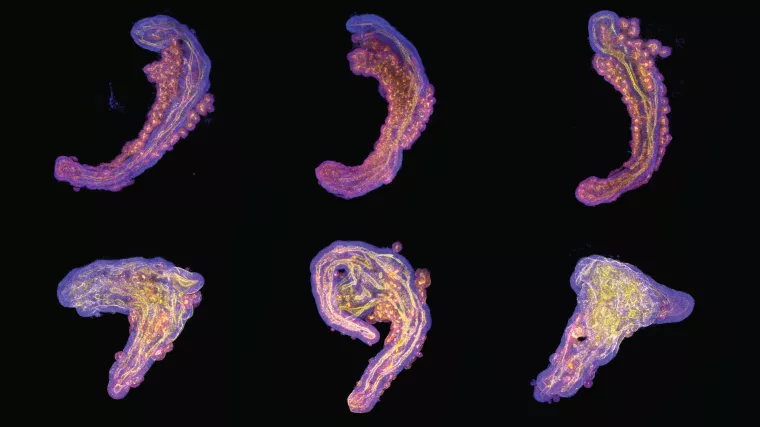 Bild: Stoffwechsel prägt Leben