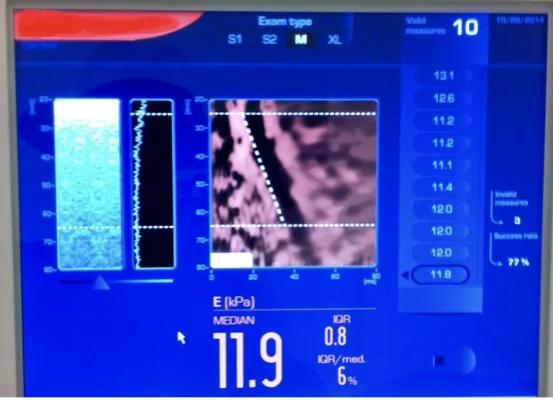 Nach HI-und Hepatitis-C-Viren bedrohen Corona-Viren die Opfer des Blutskandals - Impf-Priorisierung gefordert Bild: Nach HI-und Hepatitis-C-Viren bedrohen Corona-Viren die Opfer des Blutskandals - Impf-Priorisierung gefordert