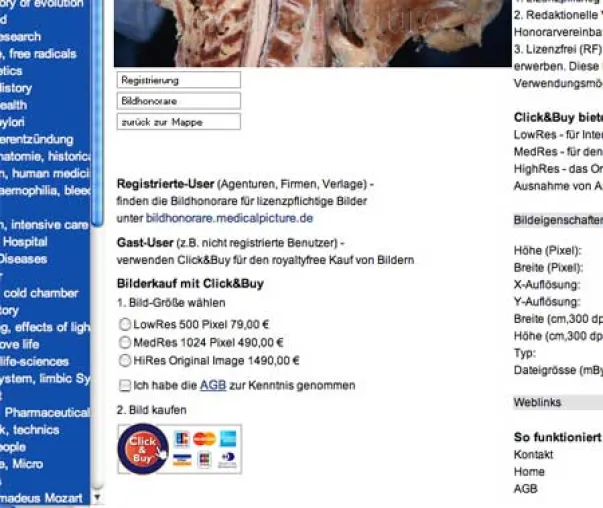 Bild: MEDICALPICTURE MIT CLICK&BUY IM ONLINE BILDERVERKAUF
