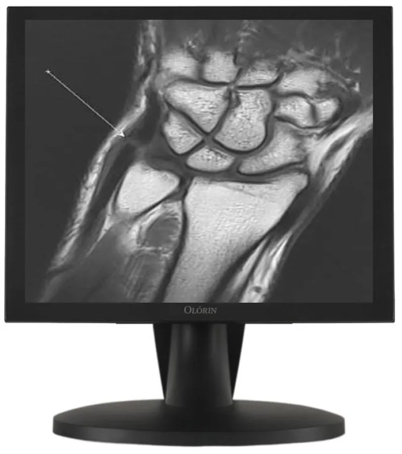 Frontsensor LCD-Display