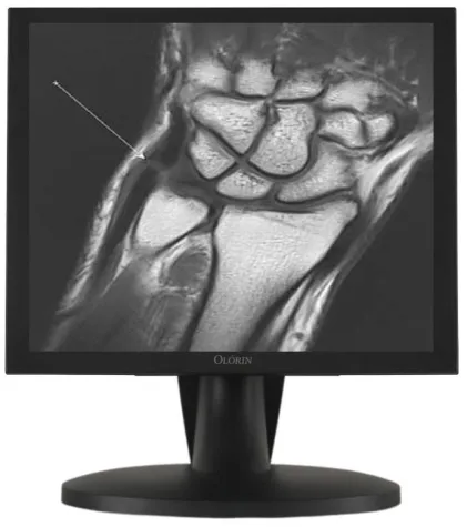 Bild: Frontsensor-LCD-Display 1,3 und 2MP für die Diagnostik