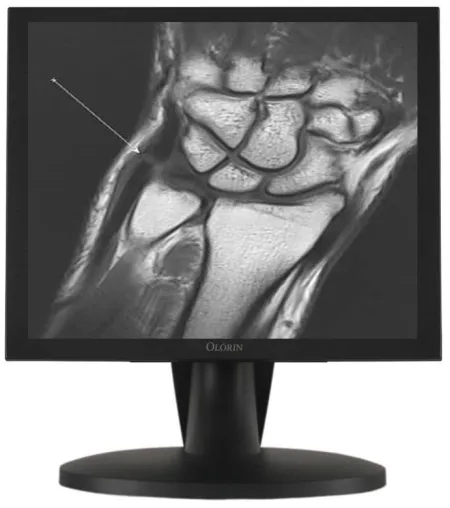 Bild: Frontsensor-LCD-Display 1,3 und 2MP für die Diagnostik