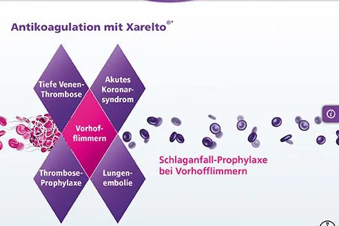 Bild: antwerpes Lead-Agentur für Xarelto in Deutschland - Healthcare Agentur gewinnt weiteren Bayer-Etat