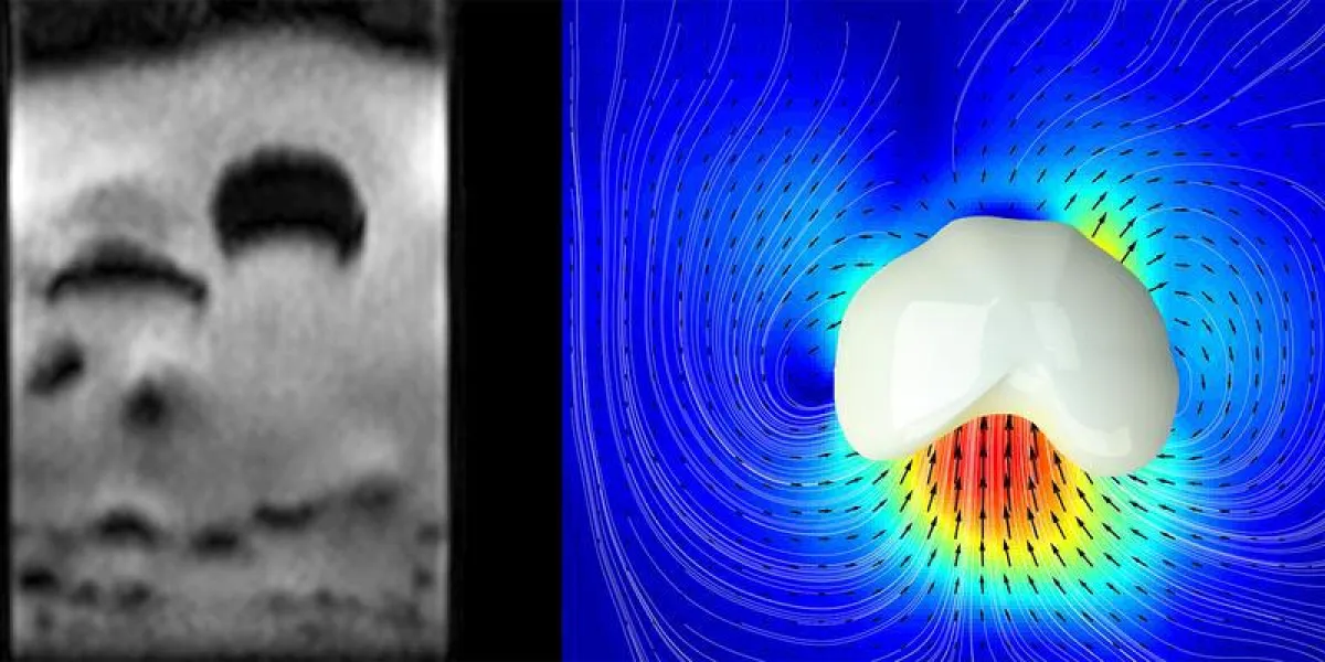 ETH-Forscher haben aufsteigende Blasen in gasdurchströmten granularen Medien mit Magnetresonanztomographie sichtbar gemacht (links). Auch die Geschwindigkeiten der Partikel (Pfeile im rechte (Bild: Al