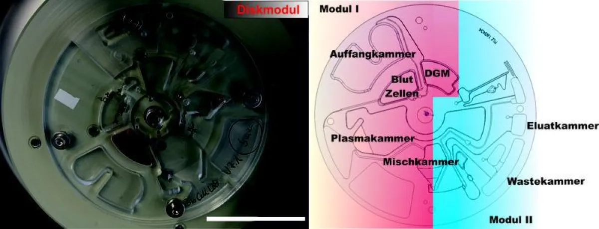 Abb. 1: Diskplattform bestehend aus Modul I und II und den Kammern für die entsprechenden Prozessschritte. Der Messbalken entspricht 5cm. (Quelle: iba Heiligenstadt)