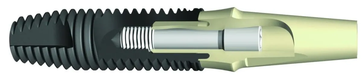 Das Abutment von PerioType X-Pert ist mit Zirkoniumnitrid beschichtet.