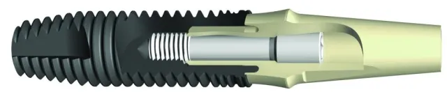 Zirkoniumnitrid macht Abutment-Oberflächen widerstandsfähiger Bild: Zirkoniumnitrid macht Abutment-Oberflächen widerstandsfähiger