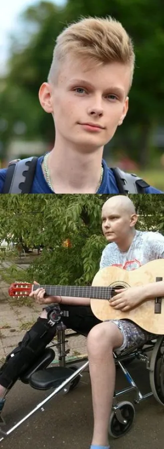 Vova vor und nach der Chemotherpie und der Bein-Amputation