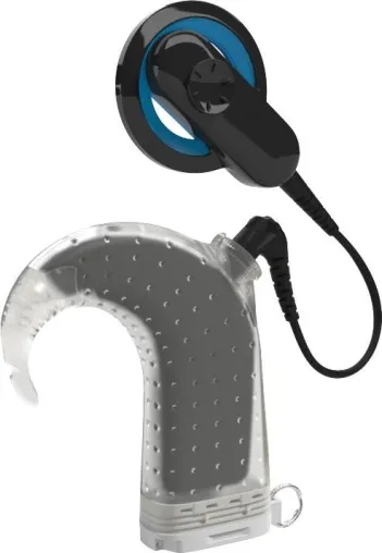 Bild: Cochlear™ Nucleus® Aqua+ ist die erste wasserdichte CI-Lösung, die hinter dem Ohr getragen wird