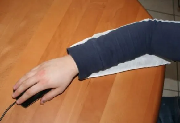 Bild: Dem "Mausarm" kann geholfen werden