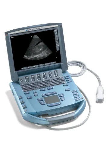 SonoSite stellt Sono-IQ Platform™ für das MicroMaxx®-System vor Bild: SonoSite stellt Sono-IQ Platform™ für das MicroMaxx®-System vor