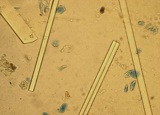 Bild: Chemische Schadstoffe in Gebäuden - Alte Probleme auch bei neuer Bauweise