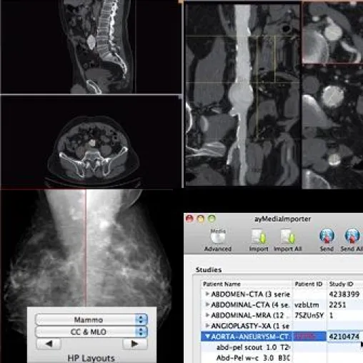 Bild: aycan erweitert seinen beliebten PACS-Viewer OsiriX PRO