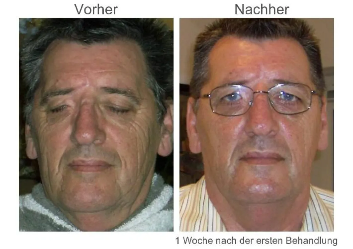 Galvanic Spa, TEAM TIME OUT, Wellness, Anti-Aging, Galvanischer Heilstrom, Akne, Faltenreduzierung, Facelifting, Haarverlust, Glatze, Cellulite, Verjüngung, Jung bleiben, Haare, Produkte gegen das Alt