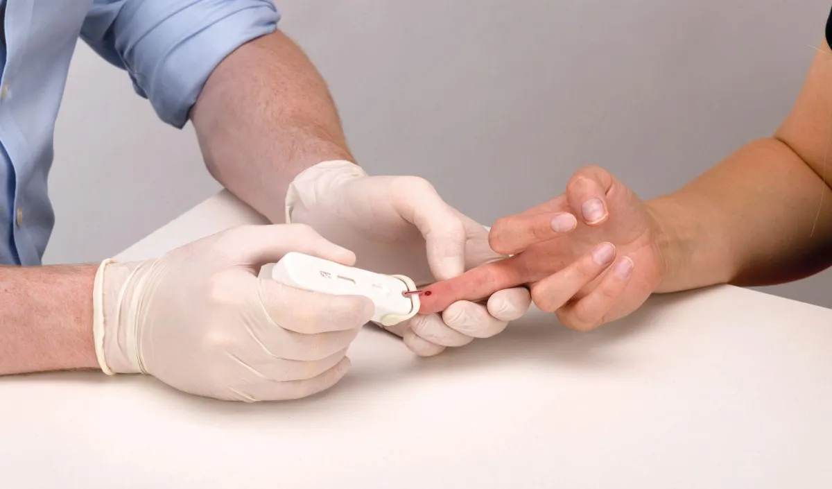 Der neue Point-of-Care-Test Simplitude Pro HIV (1 & 2)