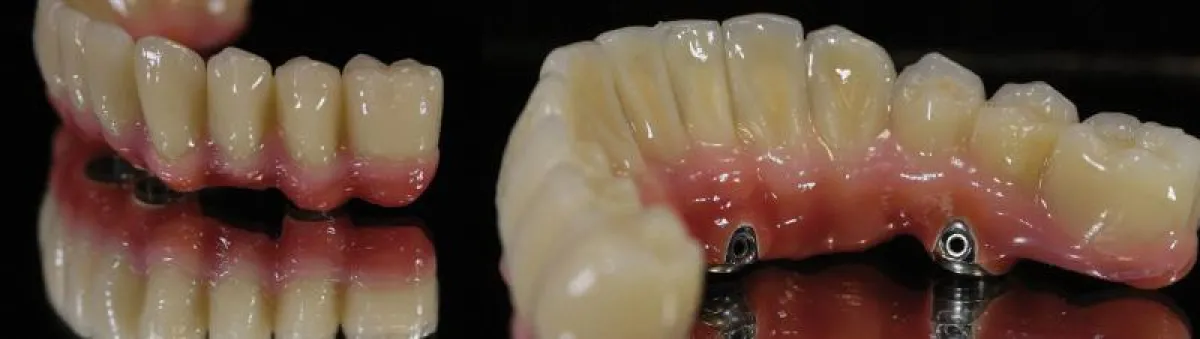 Therapiekonzepte und innovative Produkte für Zahntechnik und Zahnmedizin