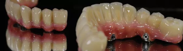 Bild: IDS 2013: Viele Probleme und Fragestellungen, eine kompetente Komplettlösung – die bredent group