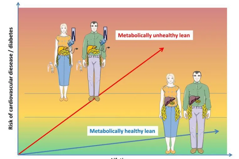 Bild: Characteristics of metabolically unhealthy lean people