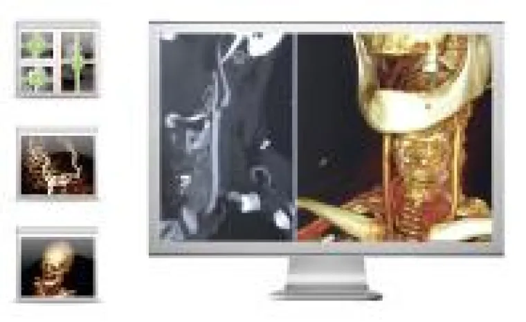 Bild: OsiriX PRO besteht Vergleich mit führenden Postprocessing Workstations