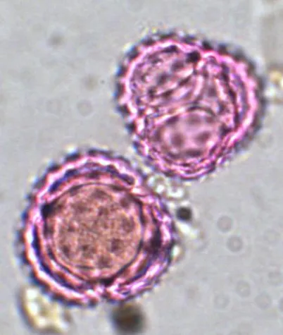 Ragweed-Pollen ab August - Neues pflanzliches Präparat gegen Pollenallergie hilft Bild: Ragweed-Pollen ab August - Neues pflanzliches Präparat gegen Pollenallergie hilft
