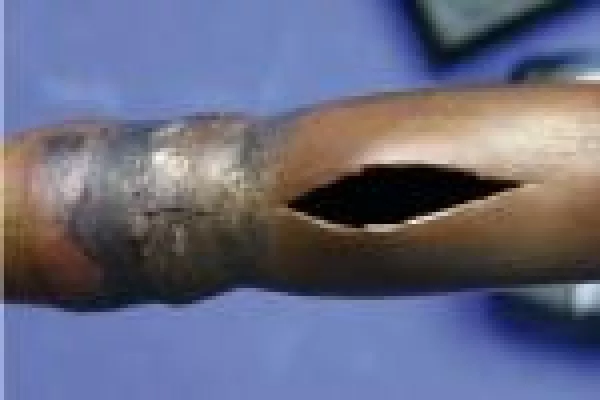 IFS rät: Leitungswasser-Frostschäden können vermieden werden Bild: IFS rät: Leitungswasser-Frostschäden können vermieden werden