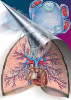 Bild: Feinstaub-Feature von medicalpicture - Gefahr durch Ruß und Raucher