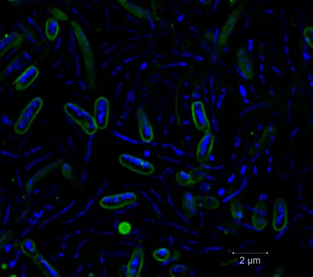 Bild: Studie: In Kroatiens Süßwasserseen horten „egoistische“ Bakterien Nährstoffe