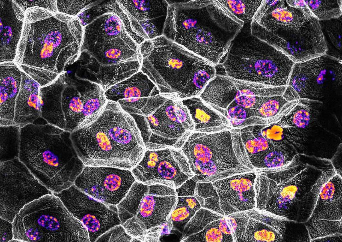 Zellen in den obersten Hautschichten bilden enge Verbindungen (grau) aus um den Transport von Molekülen und Wasser zu regulieren. Die Kerne der Zellen sind hier eingefärbt. (Matthias Rübsam )