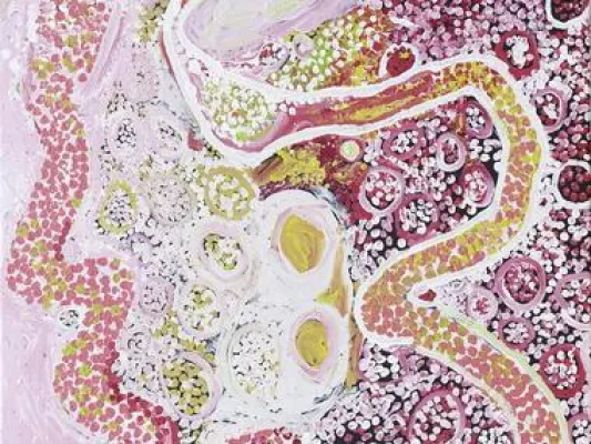 Bild: ARTKELCH zeigt Aboriginal Art in Köln - Western APY Lands im Rahmen von "Pro Community"
