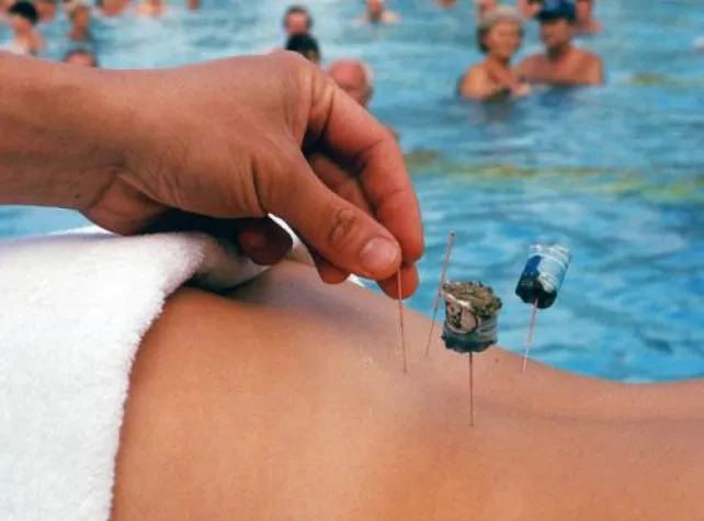 Chinesische Medizin auf Krankenschein Bild: Chinesische Medizin auf Krankenschein