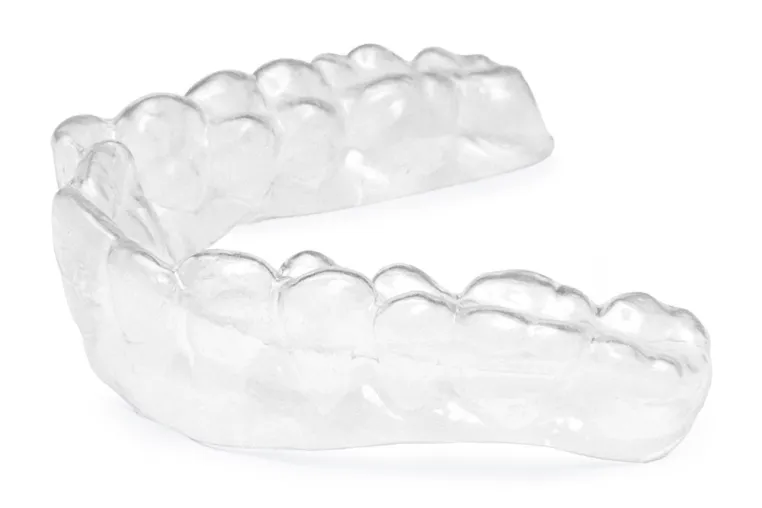 white Aligner-Therapie Bild: white Aligner-Therapie