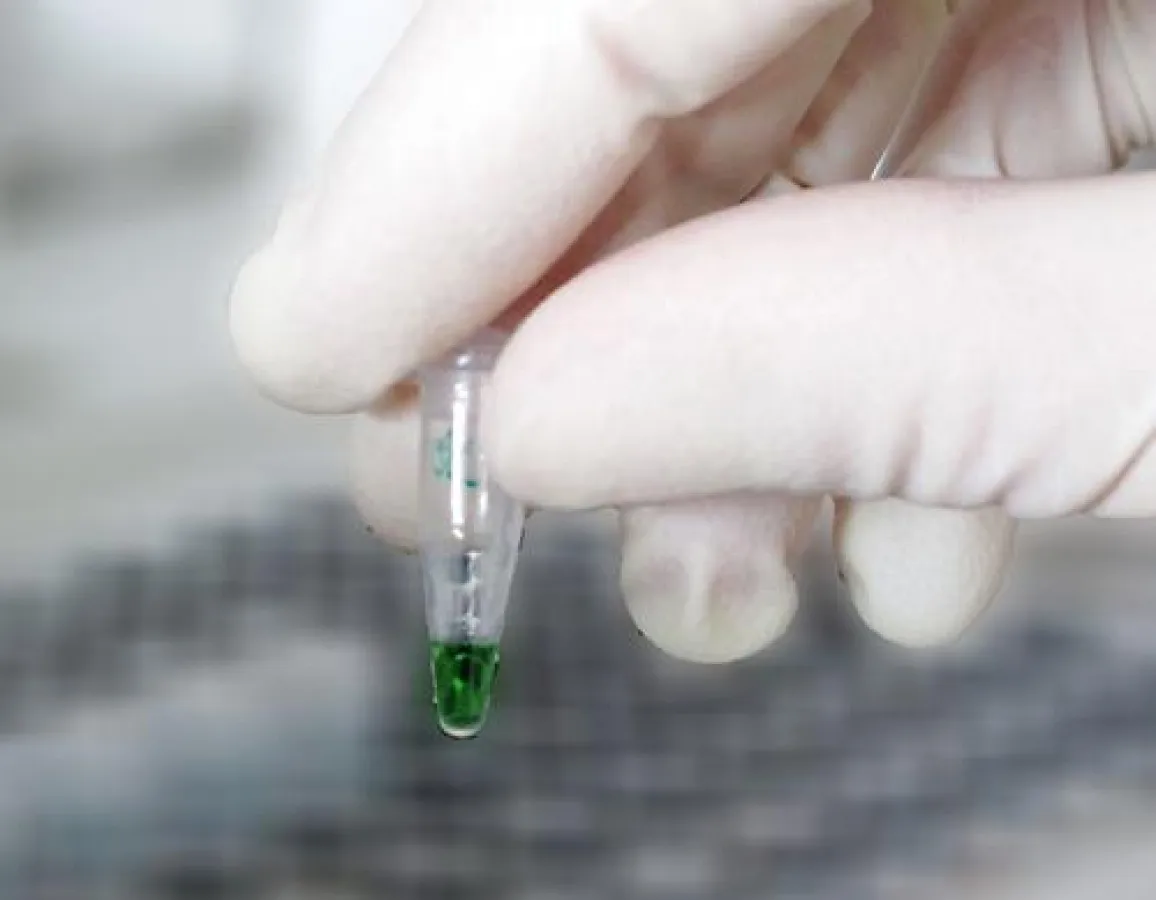 Grüne Farbe signalisiert aktive Enzyme