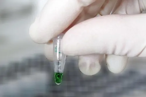Bild: Kren macht aktive Enzyme sichtbar