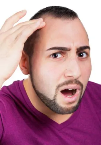 Bild: Glatze - um 80 Prozent aller Männer sind mehr oder weniger von Haarausfall betroffen