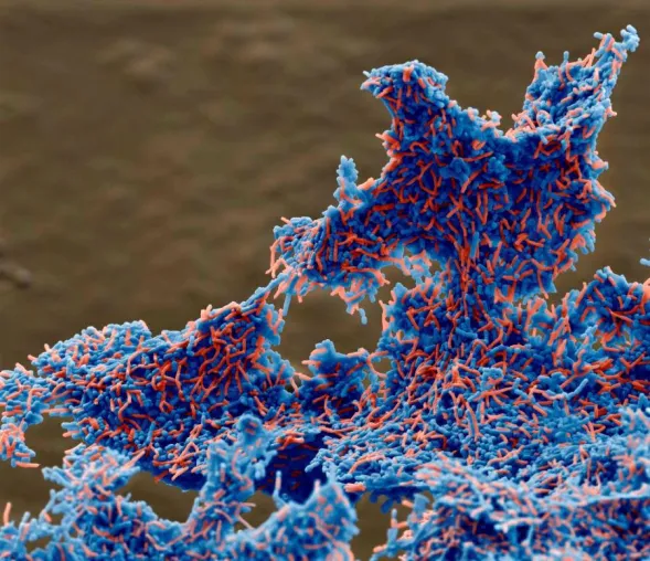 Bild: Deutsche Biotechnologie startet auf US-amerikanischem Markt: Wirkstoff für Millionen Helicobacter-Betroffene