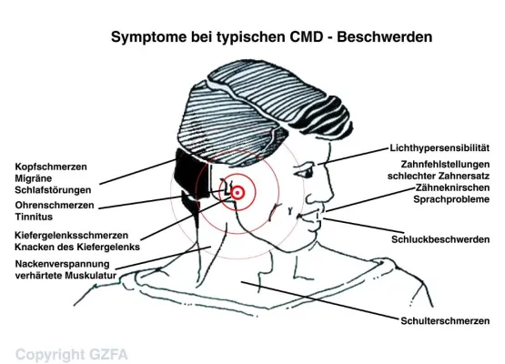 Männer unter Stress - GZFA weist auf Zusammenhänge zwischen Tinnitus und erkranktem Kausystem hin Bild: Männer unter Stress - GZFA weist auf Zusammenhänge zwischen Tinnitus und erkranktem Kausystem hin