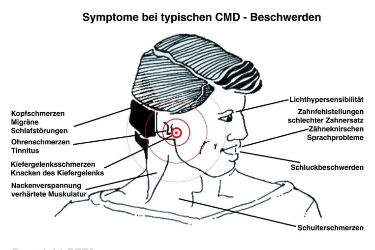Bild: Männer unter Stress - GZFA weist auf Zusammenhänge zwischen Tinnitus und erkranktem Kausystem hin