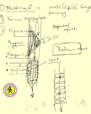 Bypass-Operationen – warum nicht in der Türkei Bild: Bypass-Operationen – warum nicht in der Türkei