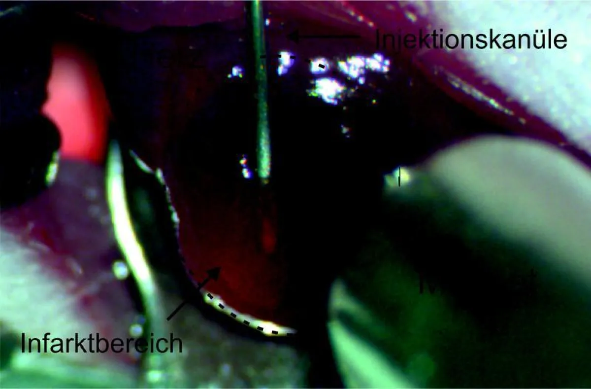 Über eine in das Infarktareal eingebrachte Kanüle werden die mit magnetischen Nanopartikeln beladenen Zellen in das geschädigte Herzmuskelgewebe der Maus gespritzt.  (© Foto: Dr. Annika Ottersbach/Uni