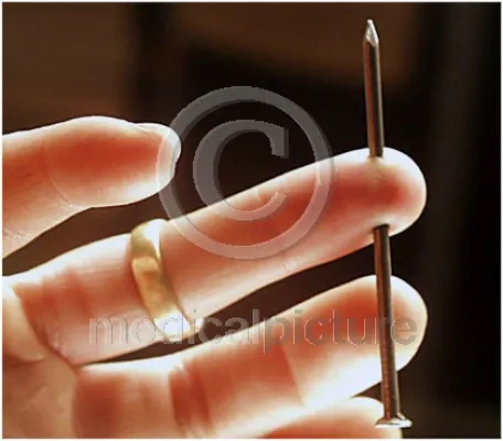 Bild: Digitales KnowHow für Fotografen - medicalpicture launcht Bildautoren Services