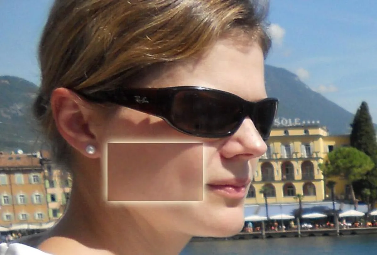 Ein jugendliches Hautbild ohne Pigmentflecken